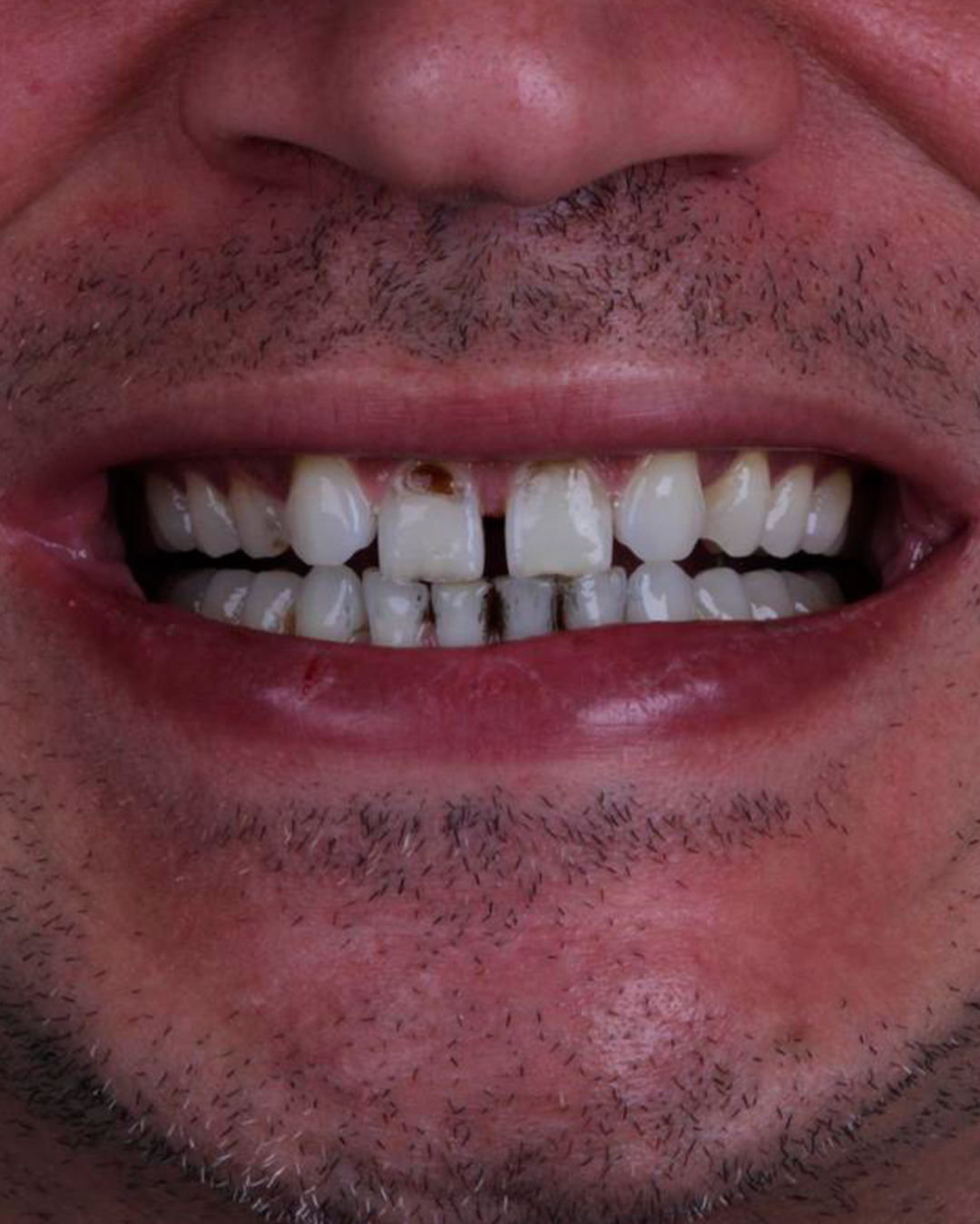 02-antes 02-antes